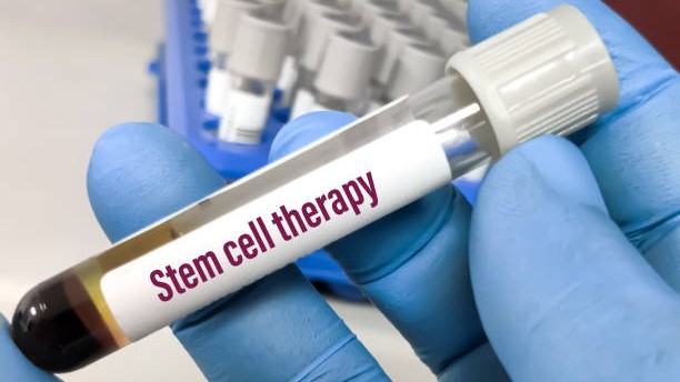 Heavy cost, complex procedures, high 
precision: Inside a stem cell therapy lab