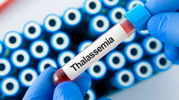 Thalassemia patients press for job quota under Disabilities Act