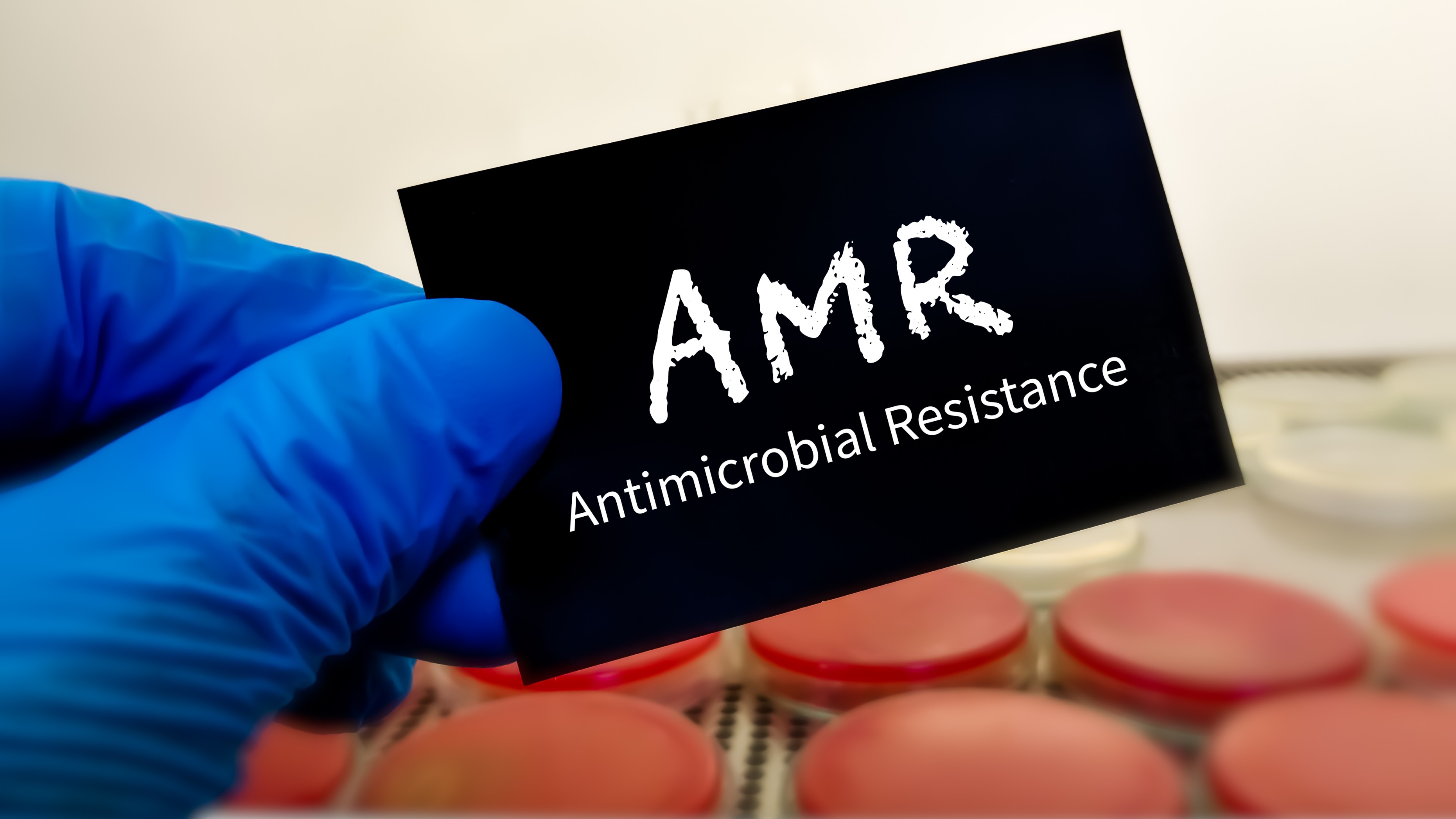 Scientists find common AMR genes in bacteria across Indian cities