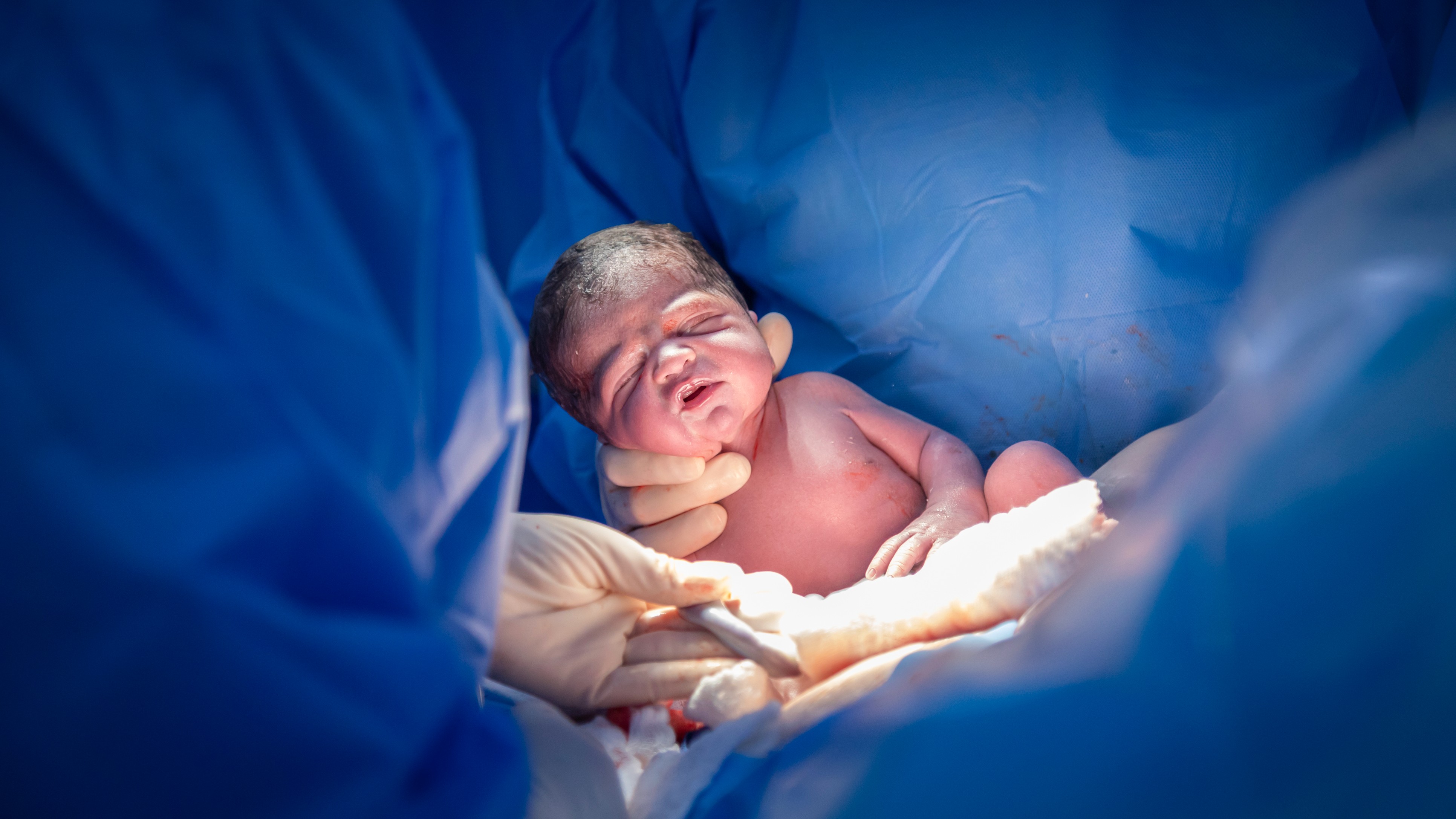 IIT study finds rise in Indian women opting for C-sections; here's why