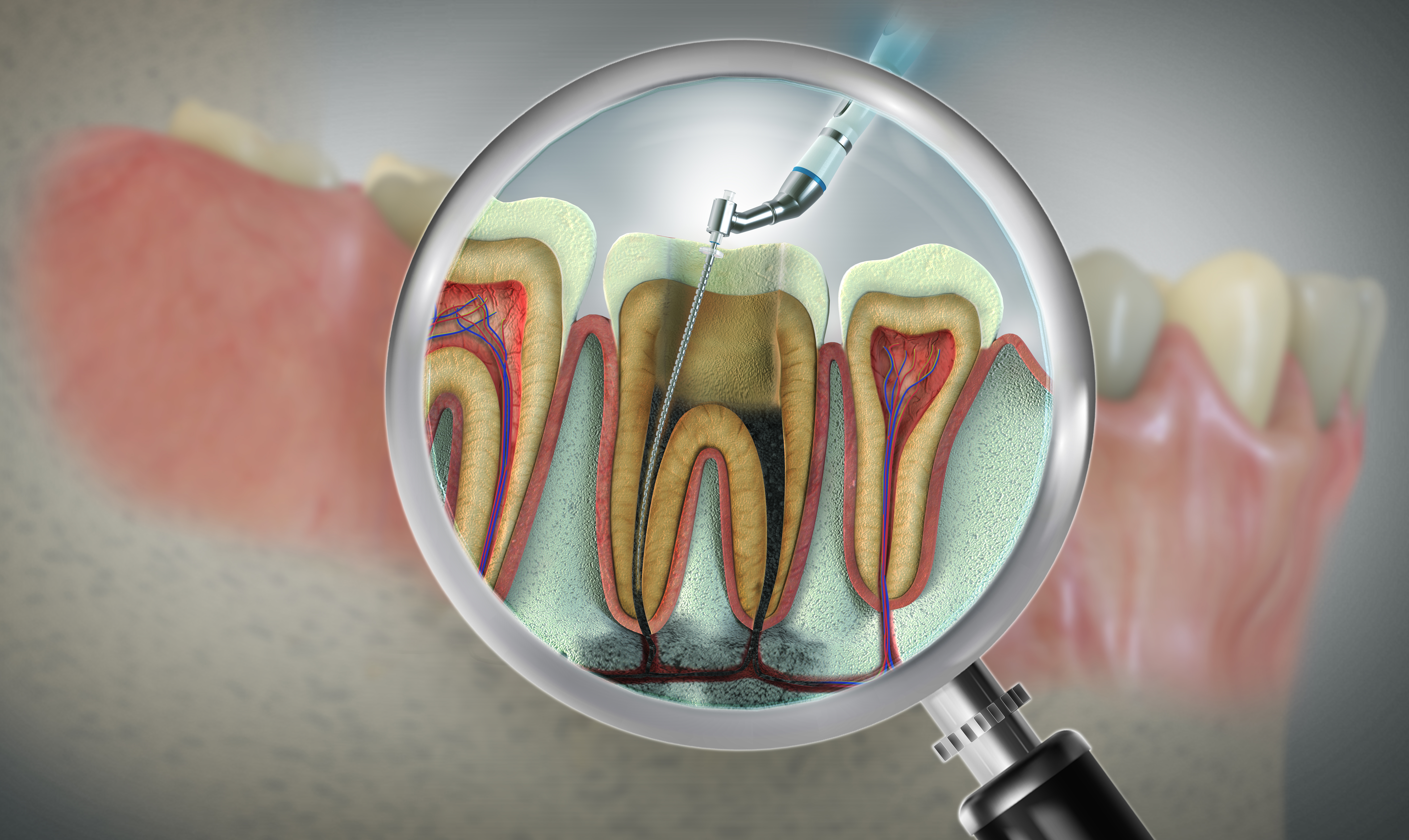 Root canal treatment now part of AB-ArK scheme: Karnataka Health department