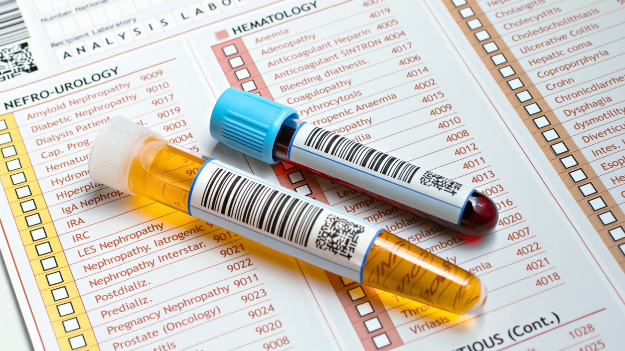 Elevated biomarkers but clean lab reports? Here's why