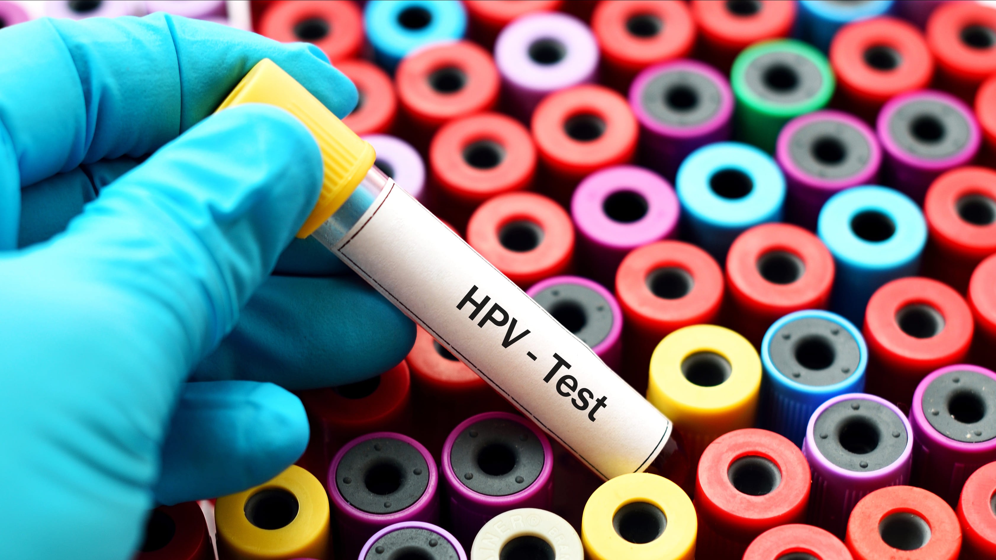 Cervical cancer: Why screening matters
