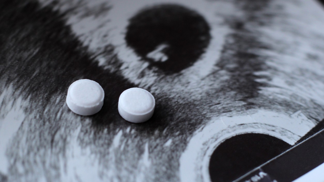 Time to rethink abortion timelines
