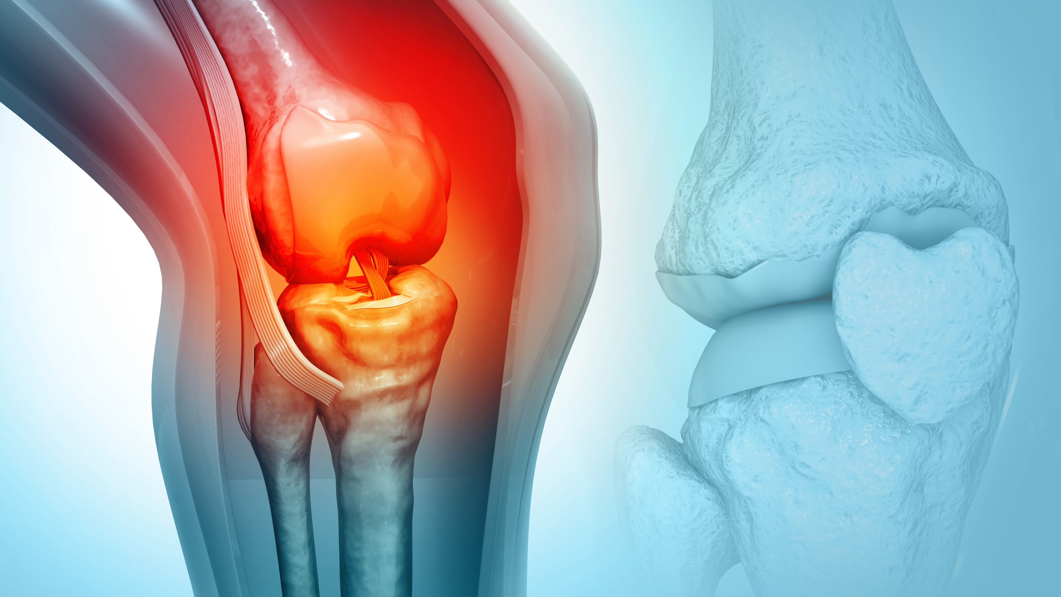 Osteoporosis raises 47% death risk in menopausal women, study warns