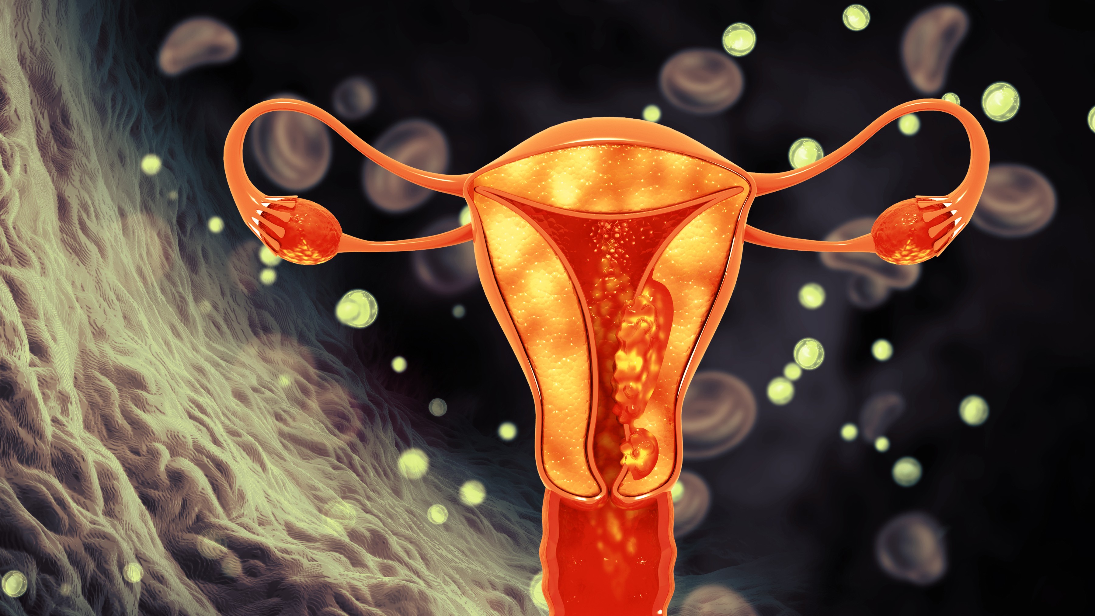 ‘PCOS to PMOS’: Landmark change of name makes this condition every doctor’s business, not just fertility clinics