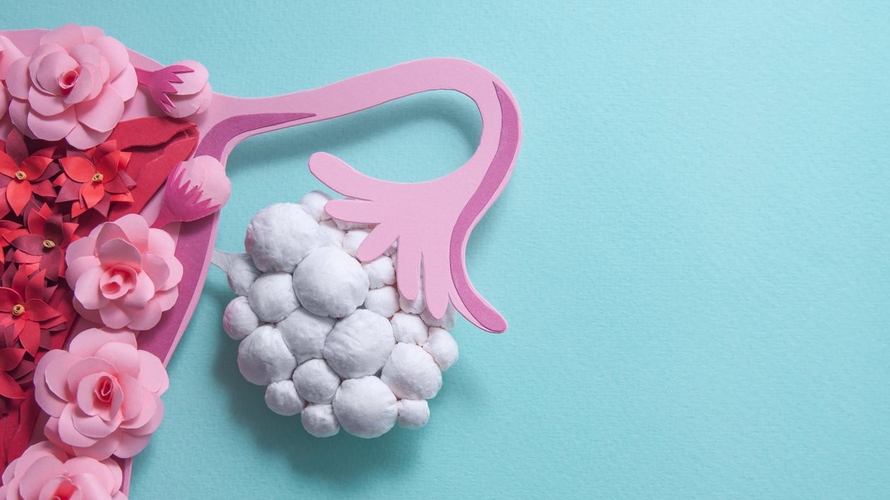PMOS is not just a period problem; here's why doctors prescribe diabetes pills