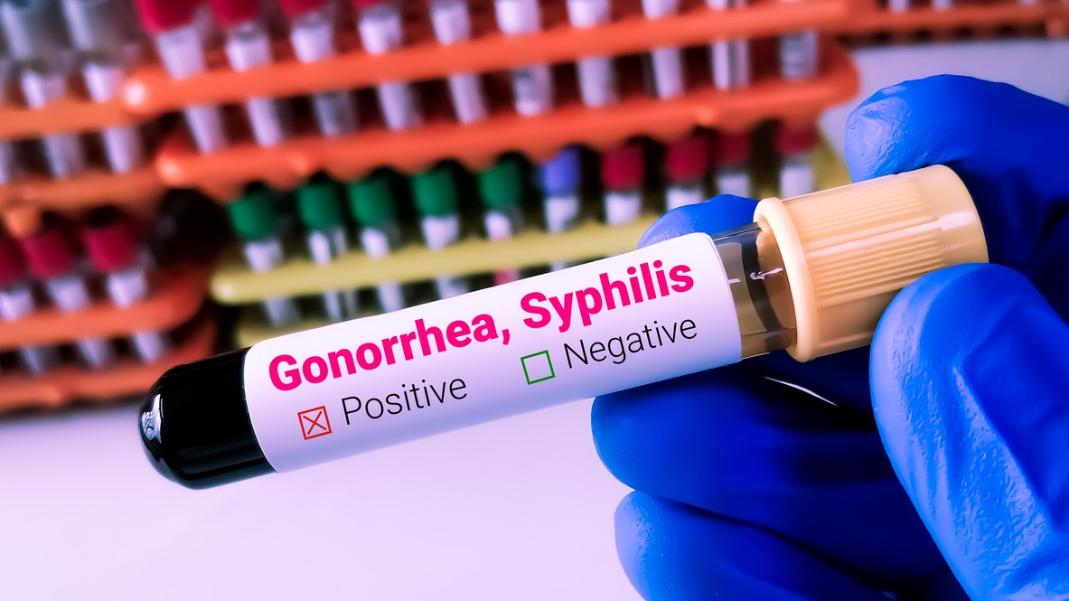 Gonorrhoea and syphilis hit record levels in Europe