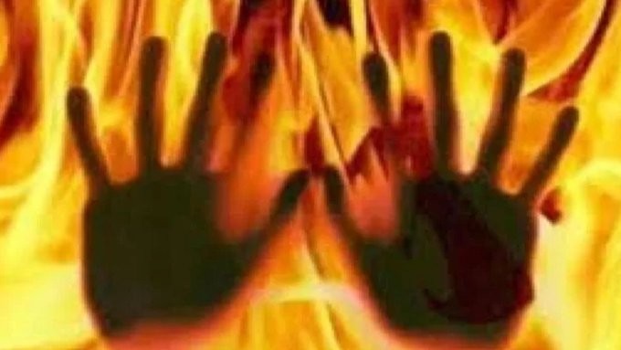 Woman, ‘lover’ arrested for tying husband to cot, setting him ablaze in UP