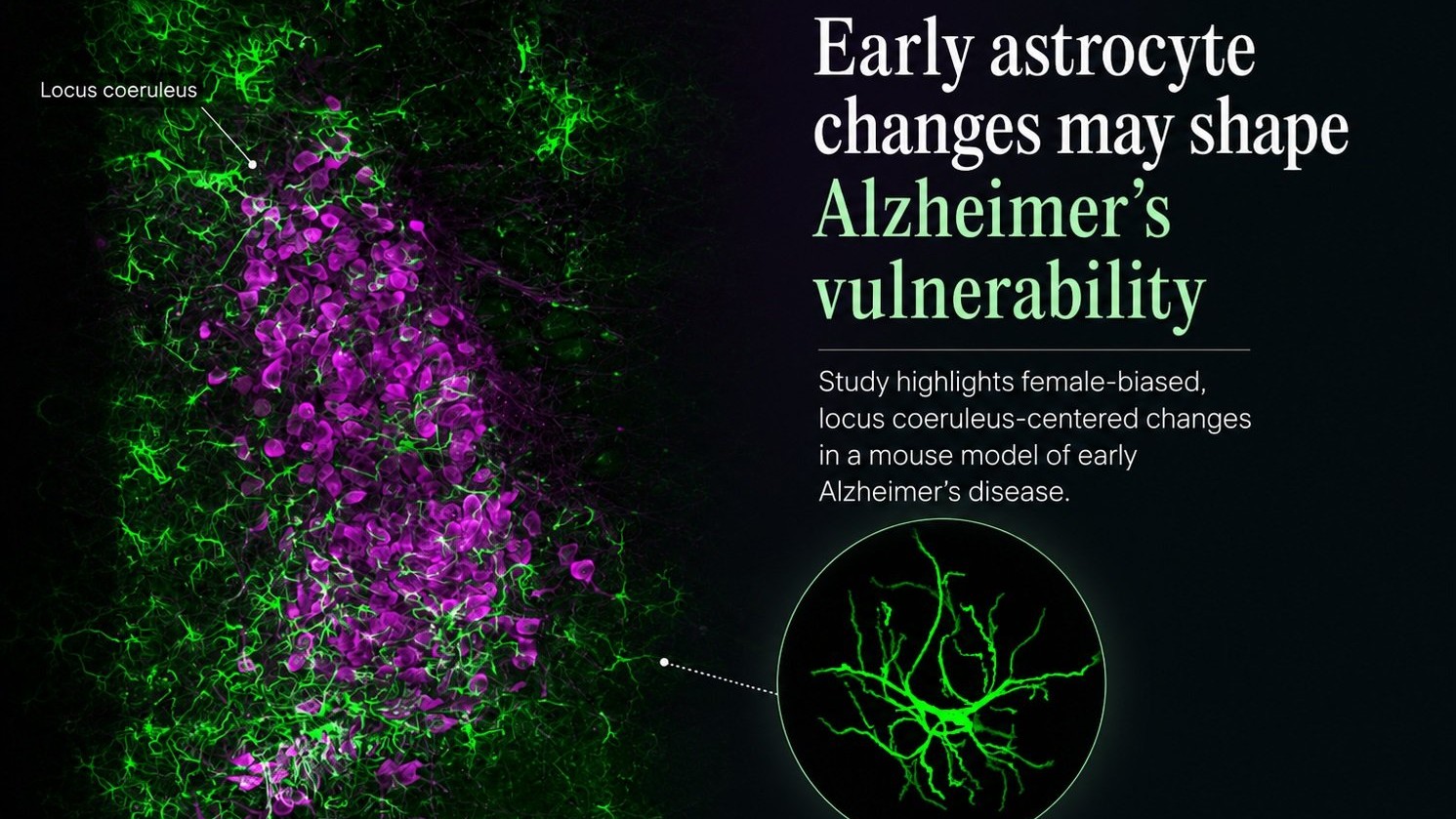 A step closer to solving the Alzheimer’s puzzle