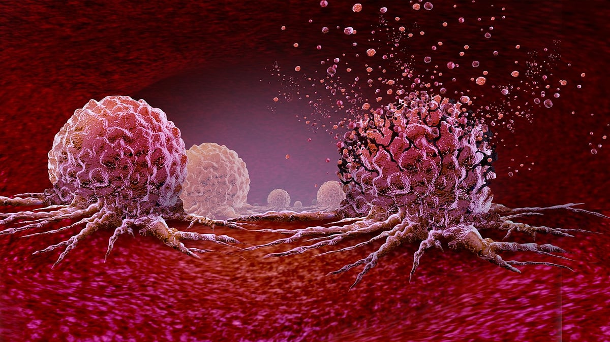 Standing ovation for pancreatic cancer breakthrough: Oncologists leave their seats in loud applause