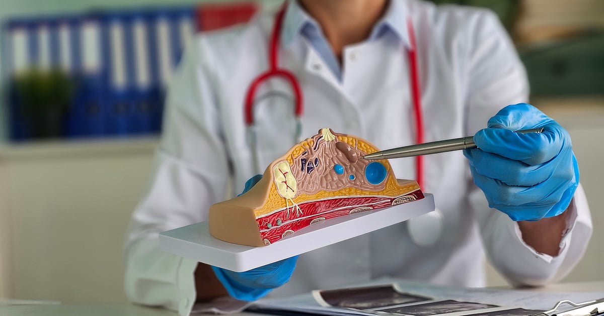 Breast cancer: Surgery a safe option