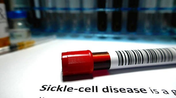 SEWA Rural wins BMJ Awards South Asia 2026 for tribal sickle cell care