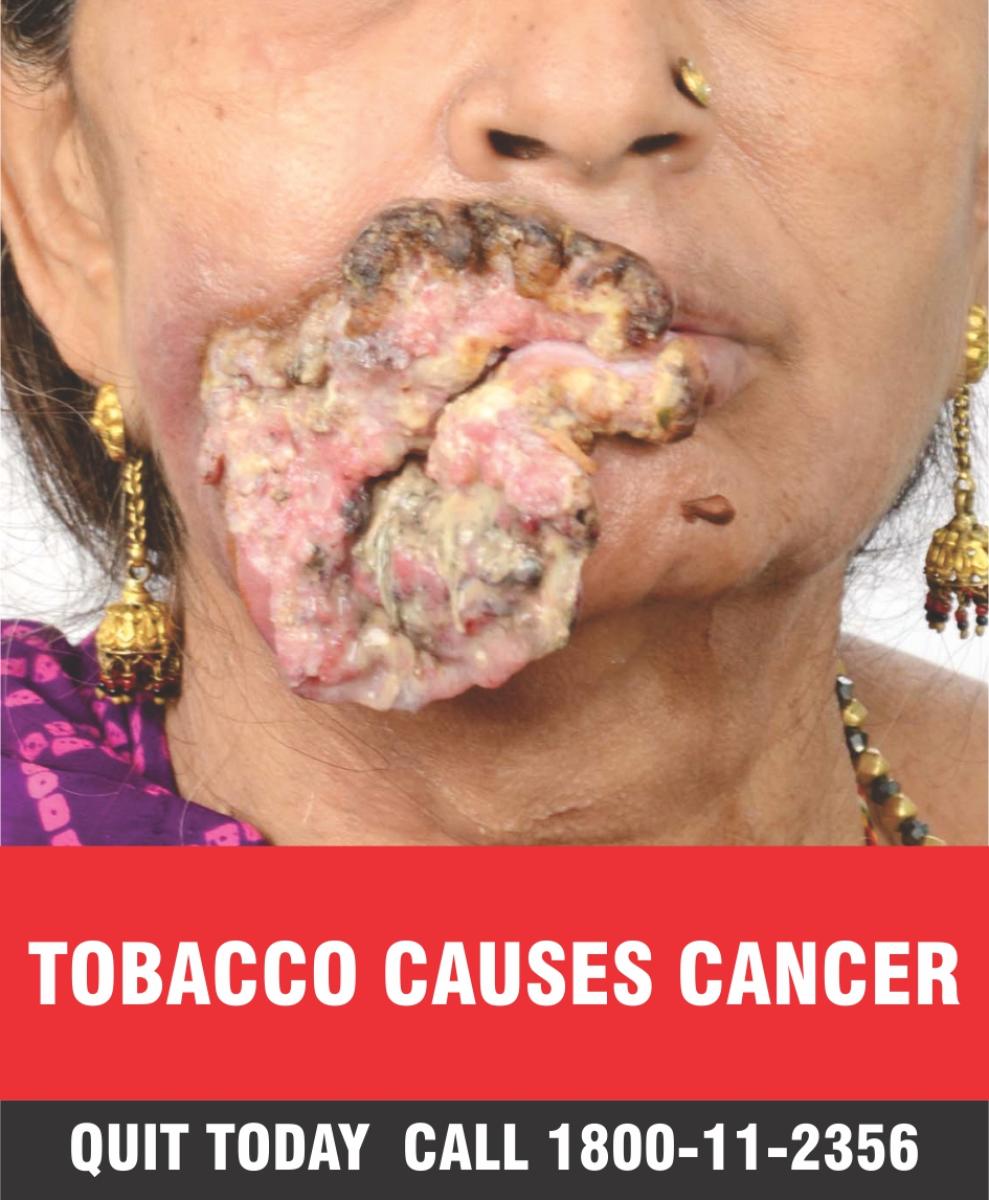 New pictorial warning for tobacco products from Sept 1