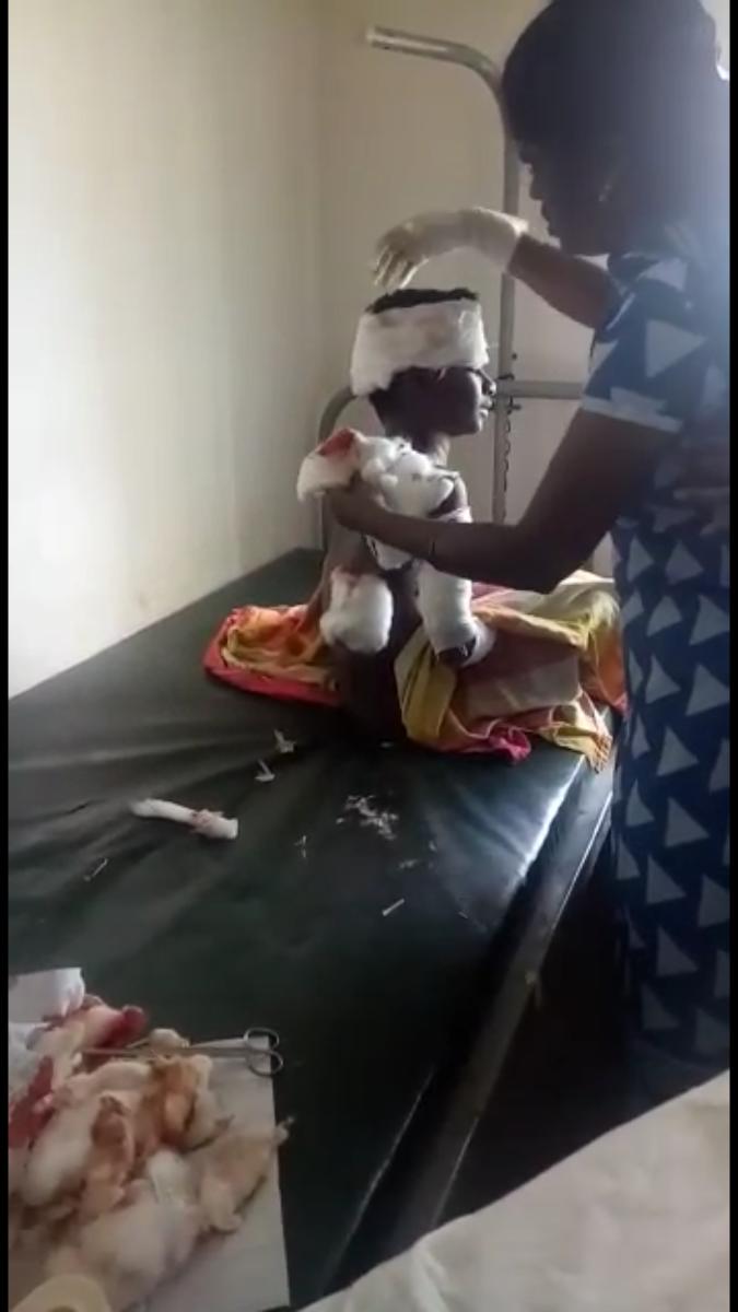 Boy, 10, mauled by 14 strays