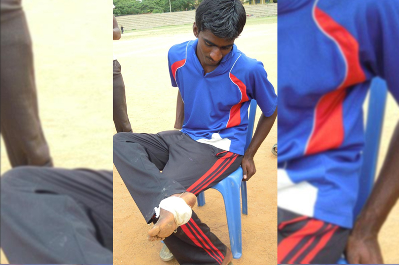 B'luru hospital to get affordable sports medicine unit