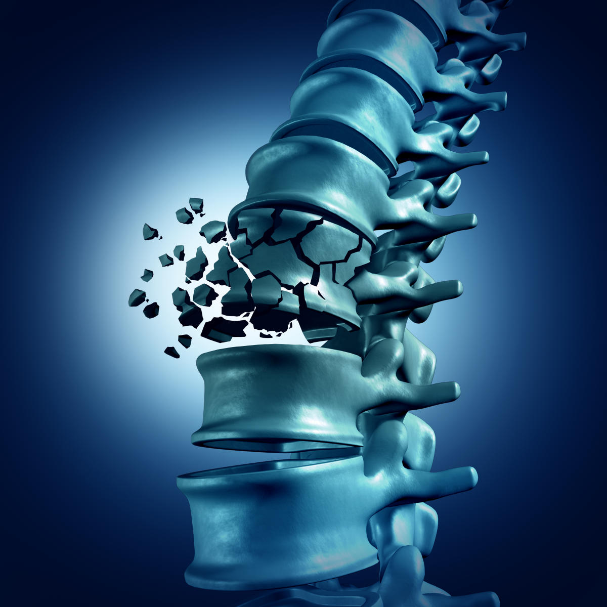 Are paediatric fractures different?