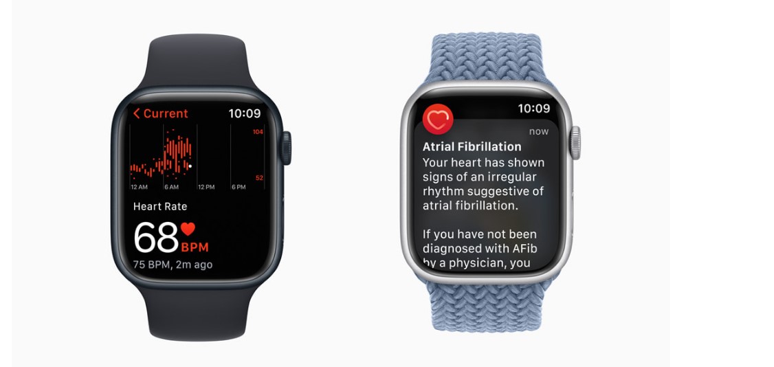 AFib app on Apple Watch. Credit: Apple