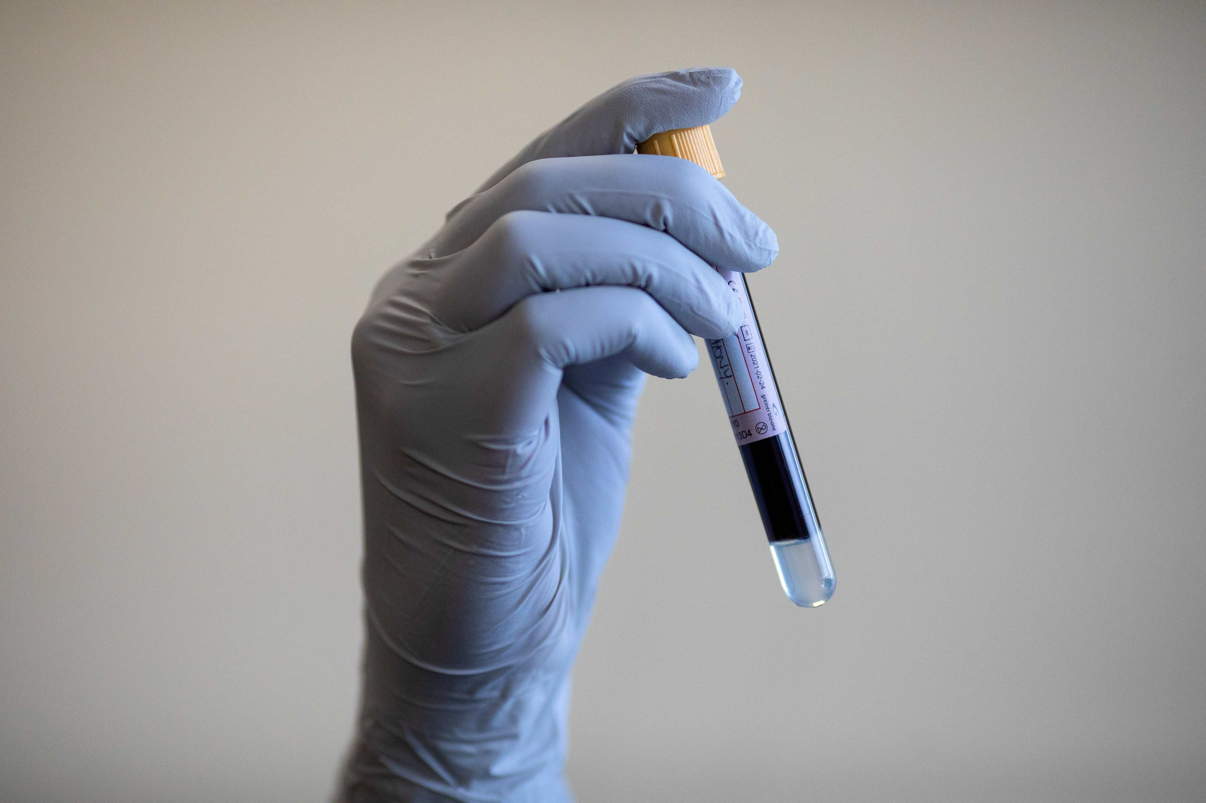 Two test Covid-19 positive in Karnataka's Udupi, booked for hiding travel history