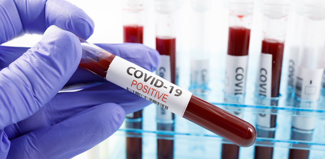 As Covid-19 cases and deaths rise, Karnataka government hides critical information