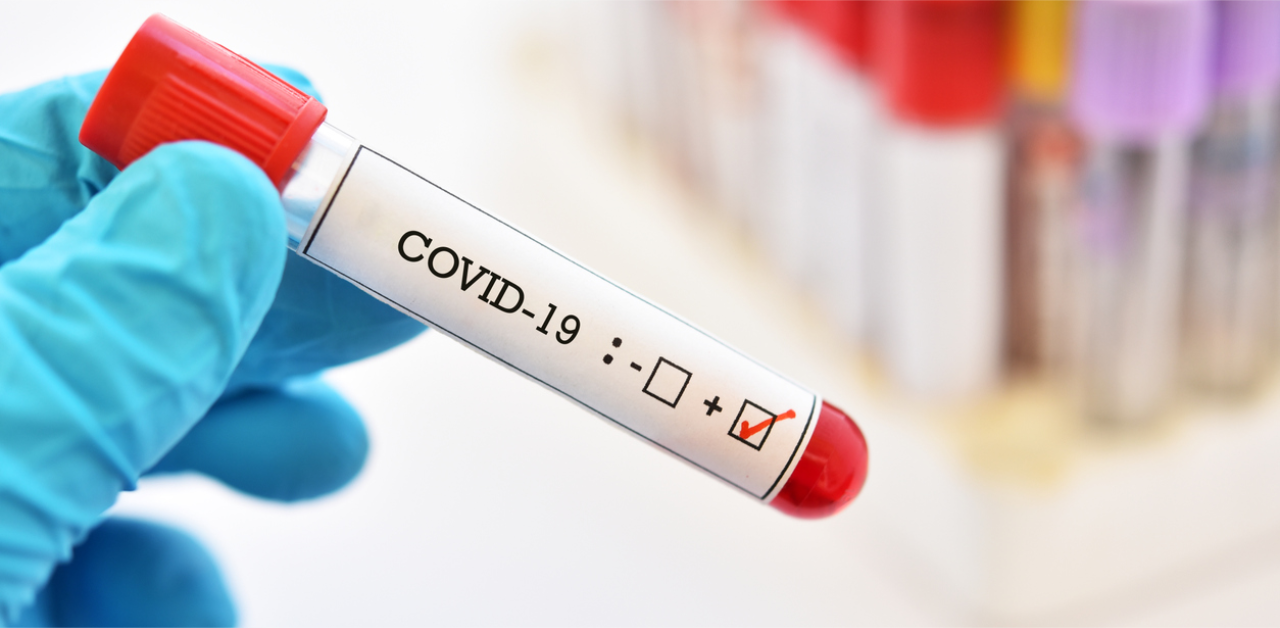 Congress veteran Motilal Vora tests positive for Covid-19, admitted to AIIMS