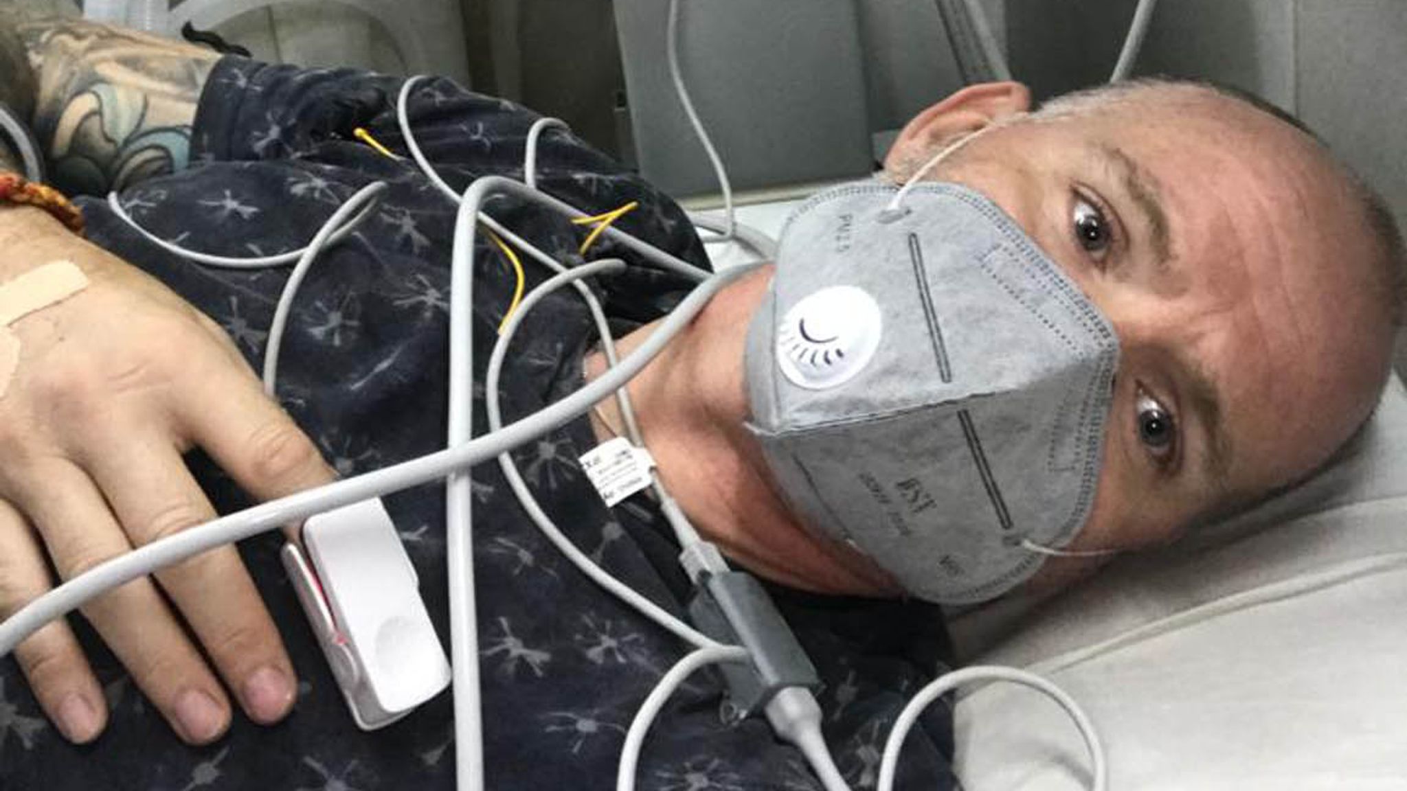 After malaria and Covid-19, British man survives cobra bite in India