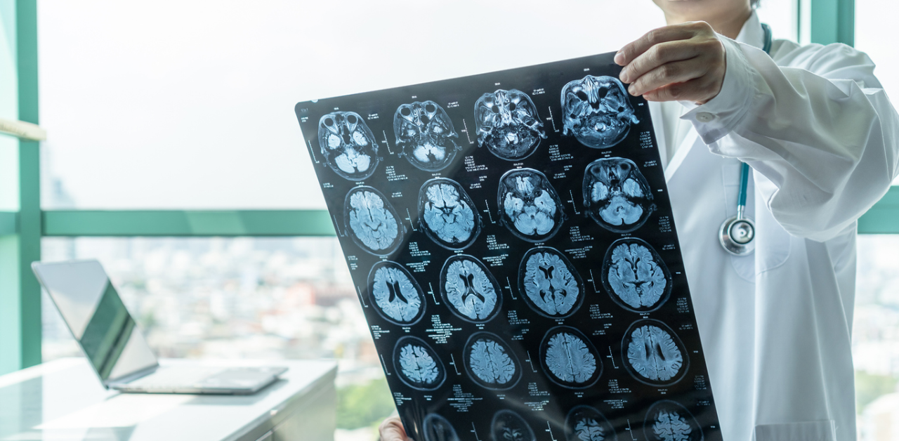 UK government launches new enquiry into long-term impact of head injuries in sport