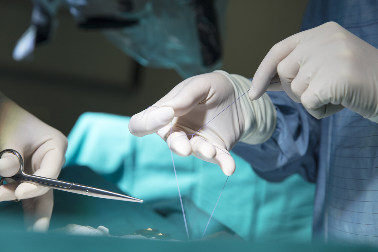 Study links C-sections with obesity, stunting in babies