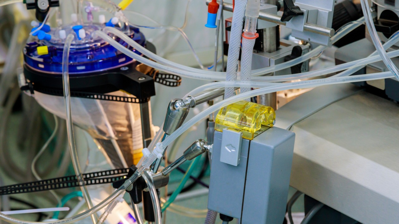 Covid-19 patient on ECMO support for 72 days recovers: hospital