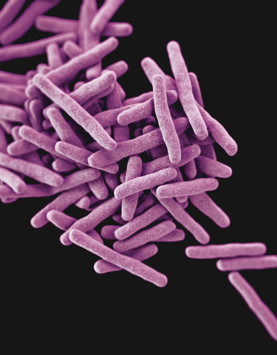 The vital TB test