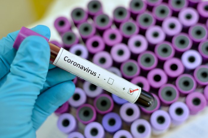Salem businessman tests positive for Covid on return from China