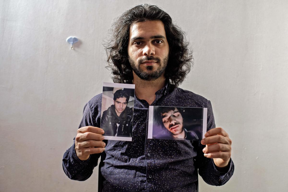 Anas Ali, 27, has lived in France as a refugee since 2019.  Before that he was in the rebel enclave of Eastern Ghouta on the doorstep of Damascus until government forces seized it in early 2018 following years of bombardment and a devastating siege.  A citizen journalist, Anas covered fighting between both sides and in 2013 was wounded, sustaining face injuries, according to the picture he showed AFP.