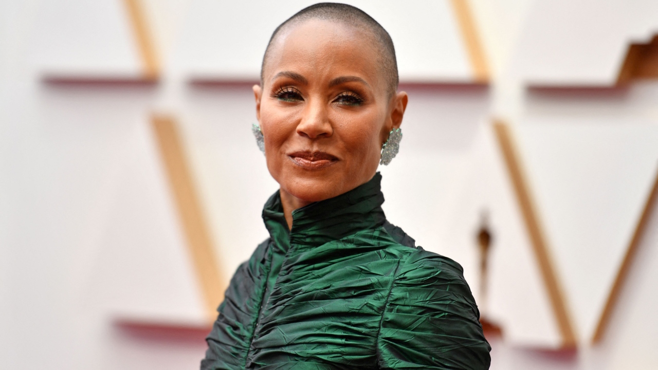 Jade Pinkett Smith – In 2018, Jade Pinkett Smith confirmed that she was diagnosed with alopecia, a rare disease, which leads to acute hair loss. It occurs when the body's white blood cells start attacking the cells of hair follicles, which leads to acute hair loss, generally in patches, at times causing complete baldness on the scalp or even the body in many cases. Credit: AFP Photo