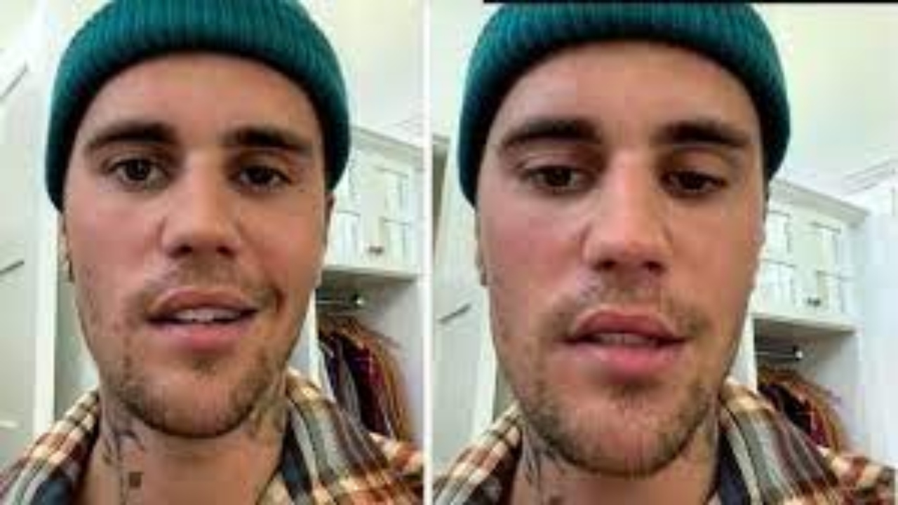 Justin Bieber – American pop star Justin Bieber has been diagnosed with Ramsay Hunt Syndrome. He took to social media to explain the serious virus that caused him partial face paralysis. According to the Mayo Clinic, Ramsay Hunt syndrome occurs when a shingles outbreak affects the facial nerve near one of your ears. In addition to the painful shingles rash, Ramsay Hunt syndrome can cause facial paralysis and hearing loss in the affected ear. Credit: Instagram/@justinbieber