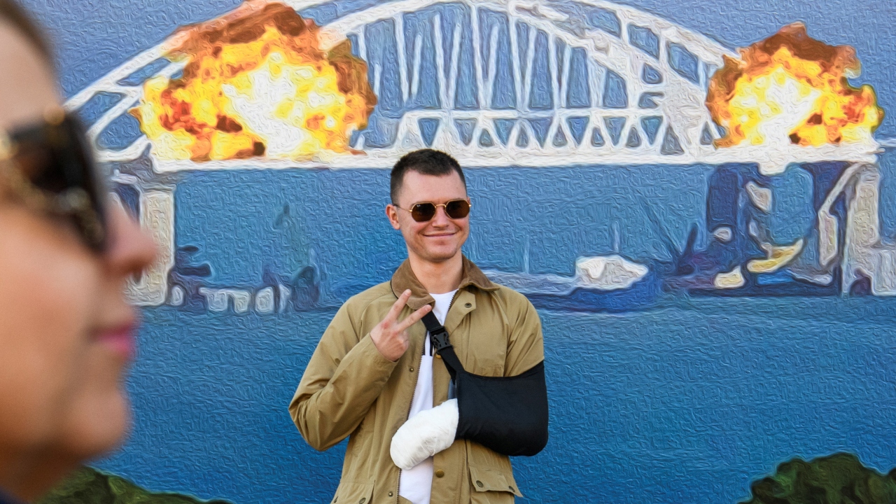 A young man could be seen smiling for a picture with the artwork despite his injuries. Credit: Reuters Photo