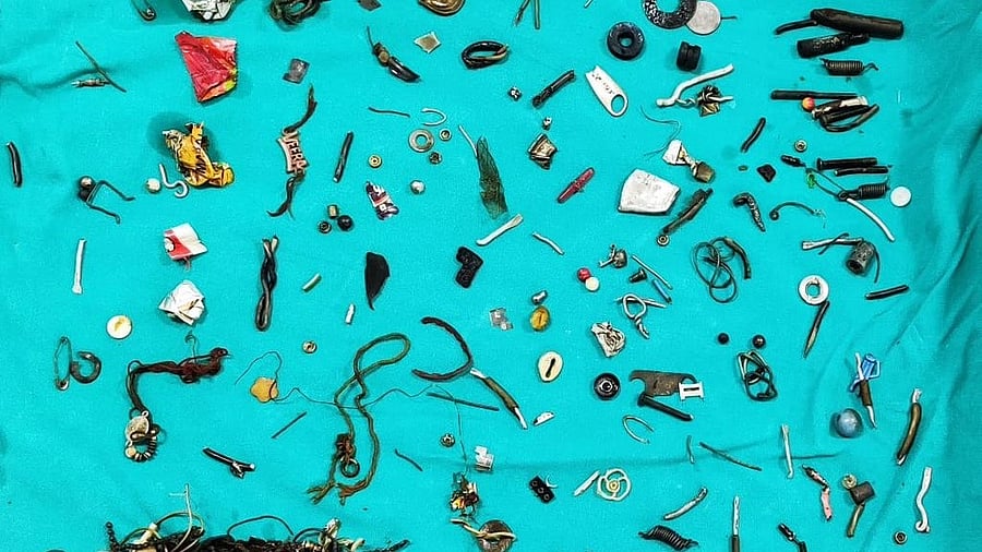 <div class="paragraphs"><p>Earphones, washers, nuts, bolts, wires, rakhis, lockets, buttons, wrappers, hairclips, a zipper tag, a marble, and a safety pin were among the almost one hundred things that were removed from his stomach after a 3-hour long surgery.&nbsp;</p></div>