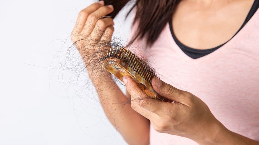 <div class="paragraphs"><p>Representative image of hairfall</p></div>