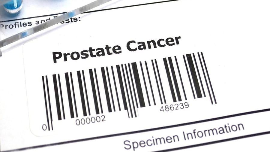 <div class="paragraphs"><p>Representative image for prostrate cancer</p></div>