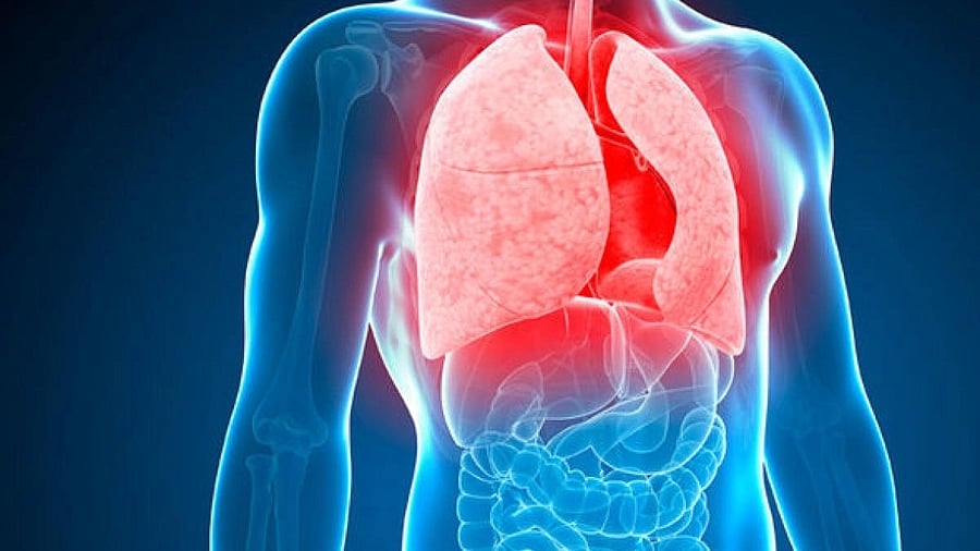 <div class="paragraphs"><p>Tuberculosis.</p></div>