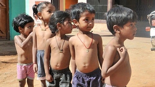 <div class="paragraphs"><p>Representative image of underweight children </p></div>