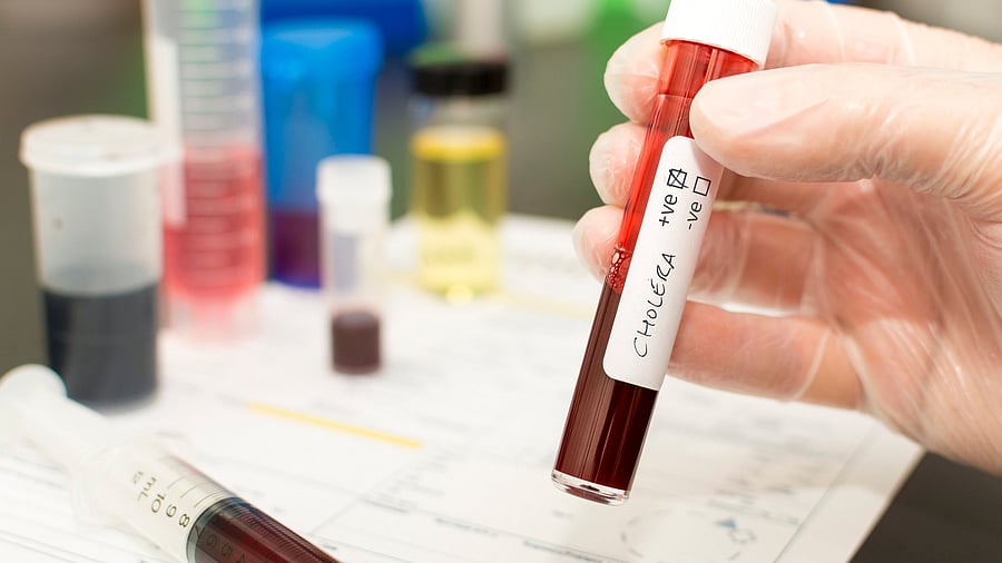 <div class="paragraphs"><p>Representative image of a blood sample in test tube with cholera written on it. </p></div>