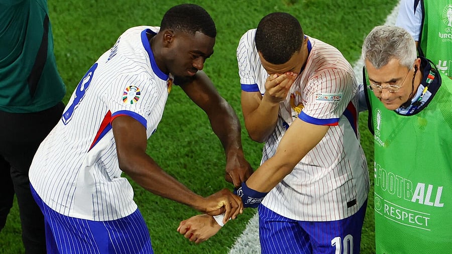 <div class="paragraphs"><p>Kylian Mbappe walks off the pitch sustaining an injury on his nose.</p></div>