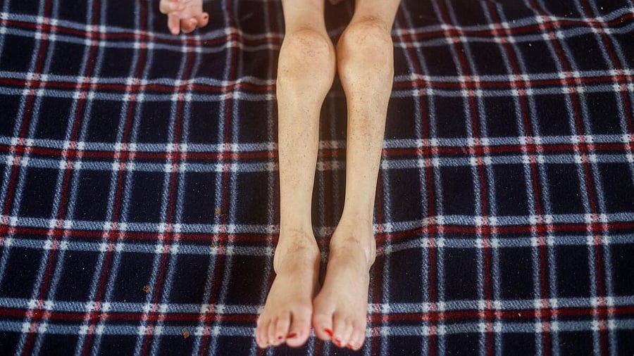 <div class="paragraphs"><p>Jana Ayad, a malnourished Palestinian child, lies on a bed as she receives treatment at the International Medical Corps field hospital, amid the Israel-Hamas conflict, in Deir Al-Balah in the southern Gaza Strip, June 22, 2024.</p></div>