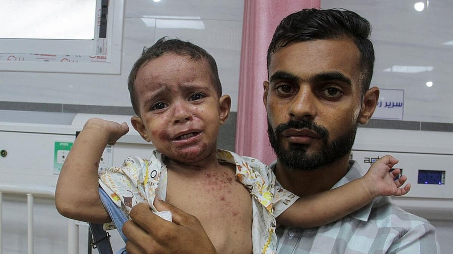 <div class="paragraphs"><p>Skin diseases worsen the plight of Gazans as war drags on</p><p></p></div>