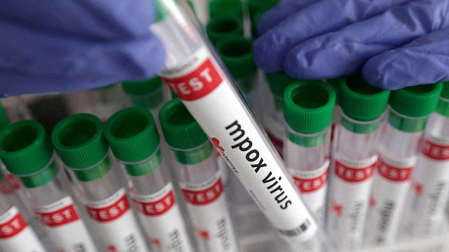 <div class="paragraphs"><p>FILE PHOTO: A test tube labelled 'Mpox virus positive'.</p></div>