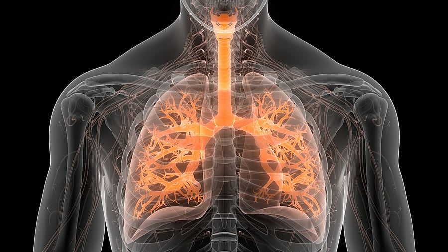 <div class="paragraphs"><p> Every 30 seconds, someone in the world will experience a flare-up of their asthma or chronic obstructive pulmonary disease (COPD) symptoms. For decades, the standard treatment for these potentially life-threatening episodes has remained unchanged – treatment with steroids, such as prednisolone.</p></div>