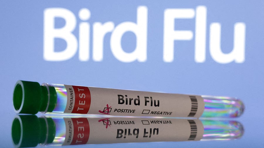 <div class="paragraphs"><p>Representative image. </p></div>