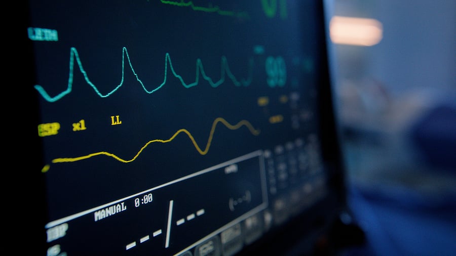 <div class="paragraphs"><p>Vitals monitor. Representational purpose.&nbsp;</p></div>