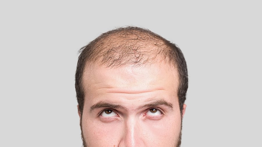 <div class="paragraphs"><p>Representative image </p></div>