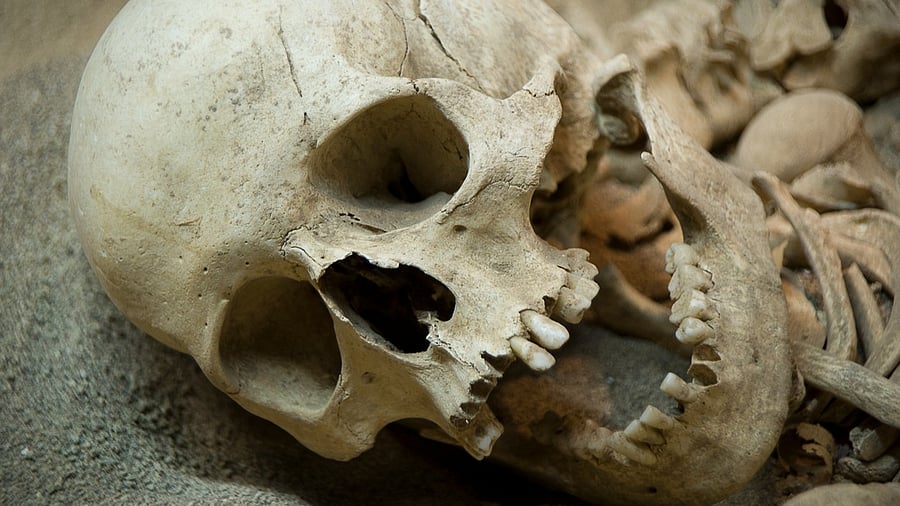 <div class="paragraphs"><p>Image showing a human skull. For representational purposes.</p></div>